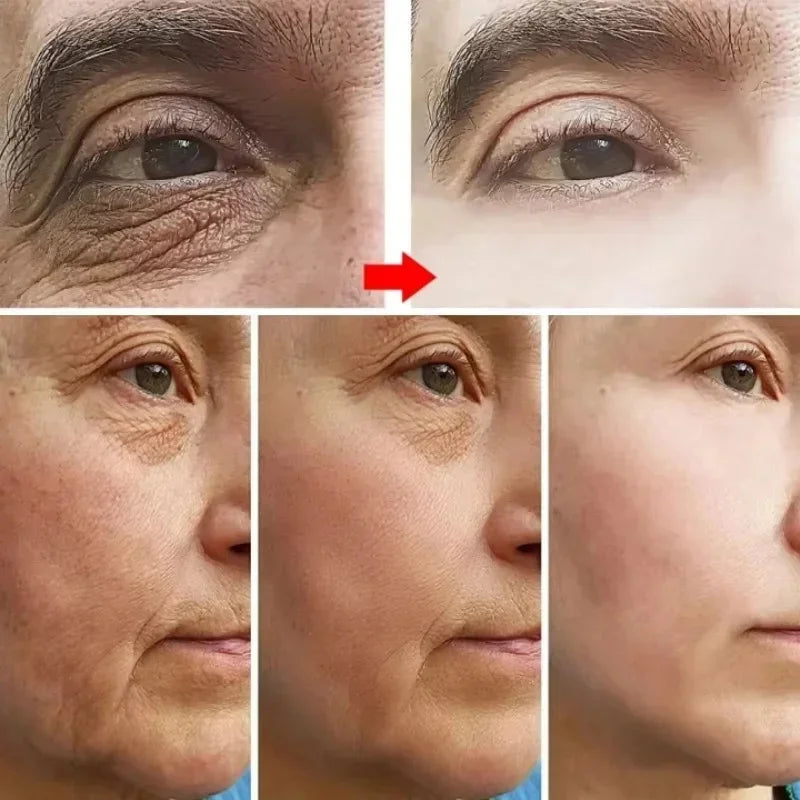 Falten entfernende Gesichtscreme Anti-Aging