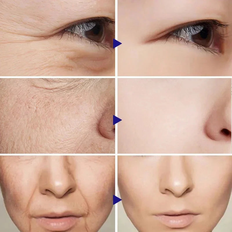 Falten entfernende Gesichtscreme Anti-Aging