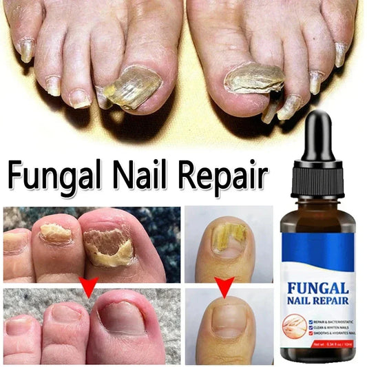 Nagelpilz Behandlung Gerät