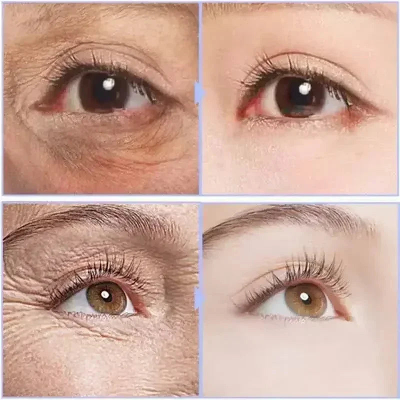 Augencreme gegen Augenringe