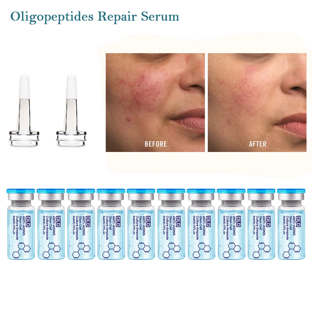 Anti-Aging-Dermaroller
