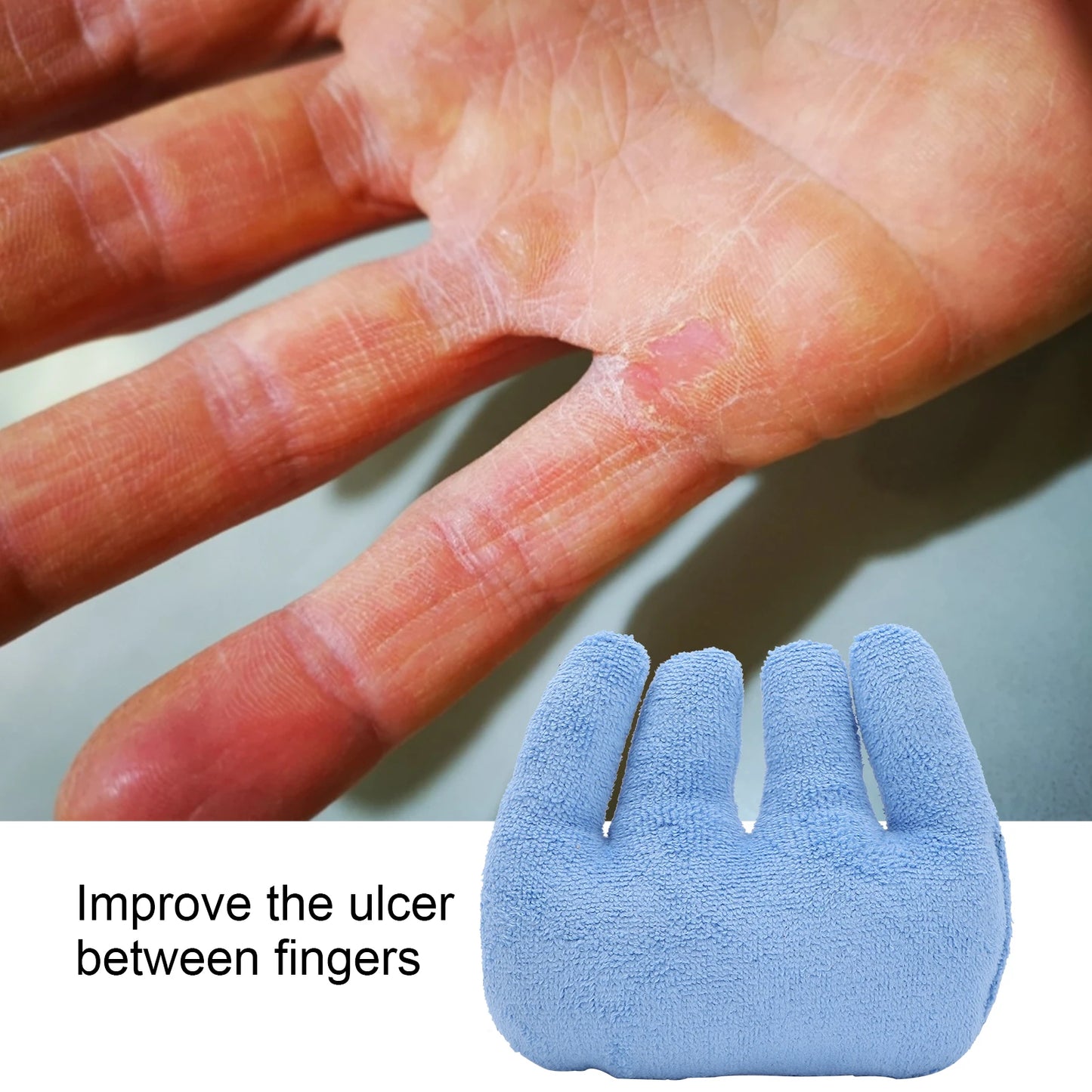Trainingsgerät zur Fingerrehabilitation
