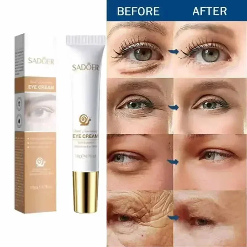 Augencreme gegen Augenringe